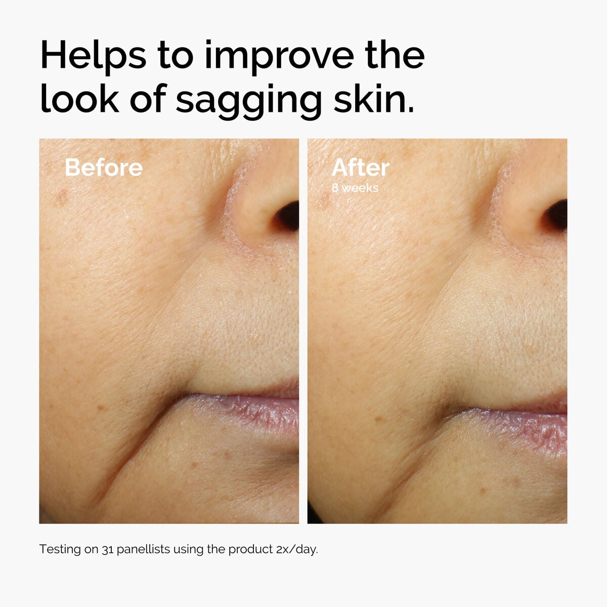 caffeine-3-escin-1-face-serum-m4 ord-caffeine-3pct-escin-1pct-face-serum-before-after-sagging.jpg