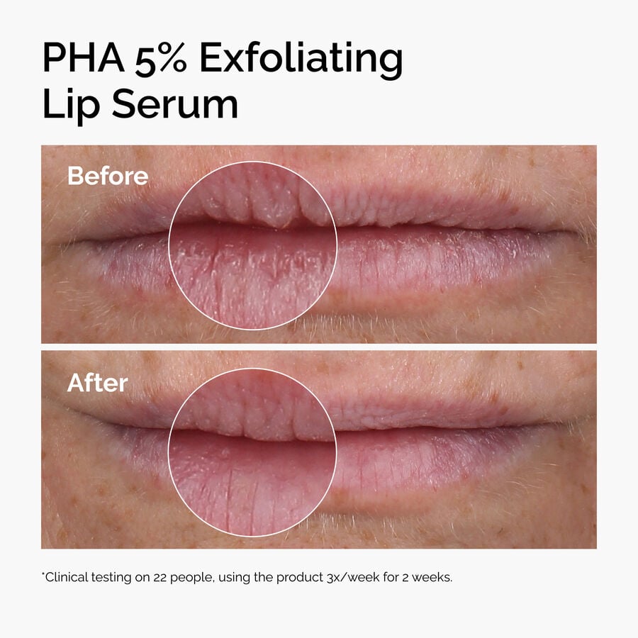 pha-5-exfoliating-lip-serum-h5 ord-pha-5pct-lip-exfoliating-serum-before-after.jpg