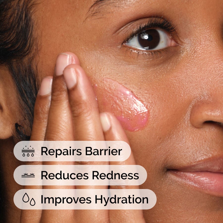 soothing-and-barrier-support-serum-v9 ord-soothing-barrier-support-serum-model-application-with-benefits.jpg